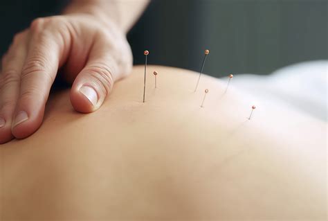 akupunktur ile zayıflama nasıl yapılır